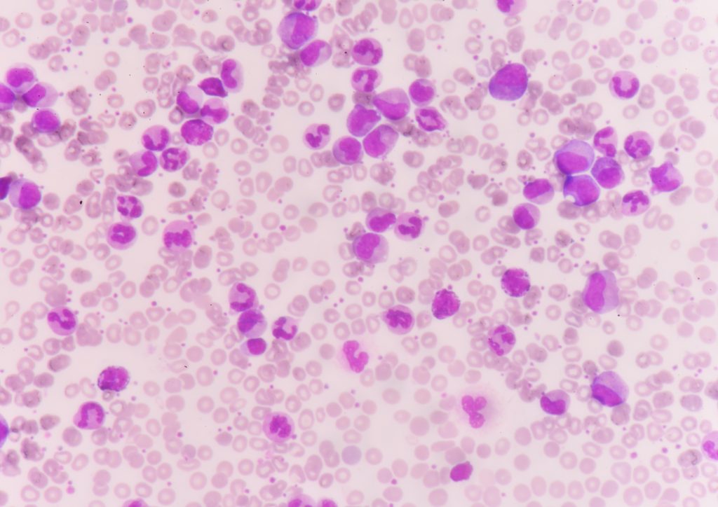 Close-up of stained cells under a microscope